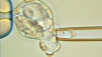 CCS Comprehensive Chromosome Screening Embryo Screening
